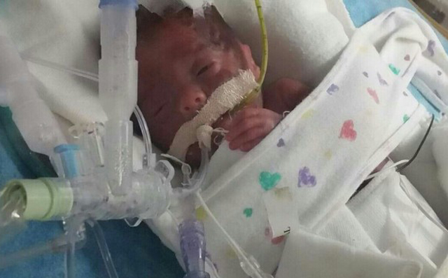 Help Dominick Joseph Gorton for his  Perforated Bowel Treatment. He is a rainbow baby, born after 7 miscarriages. Dominick was born severely premature by emergency C-section.